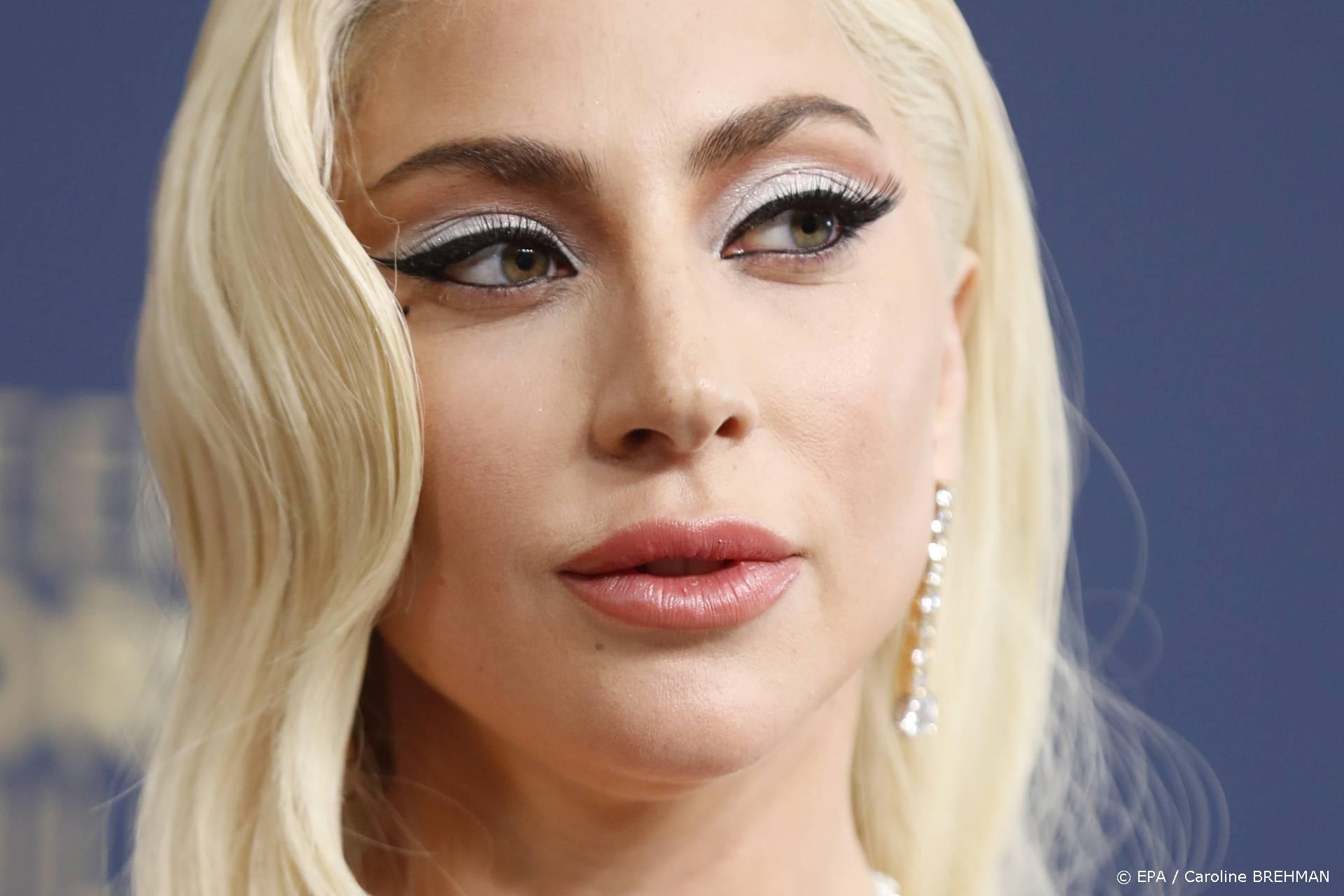 Vier jaar cel voor man die honden van Lady Gaga stal