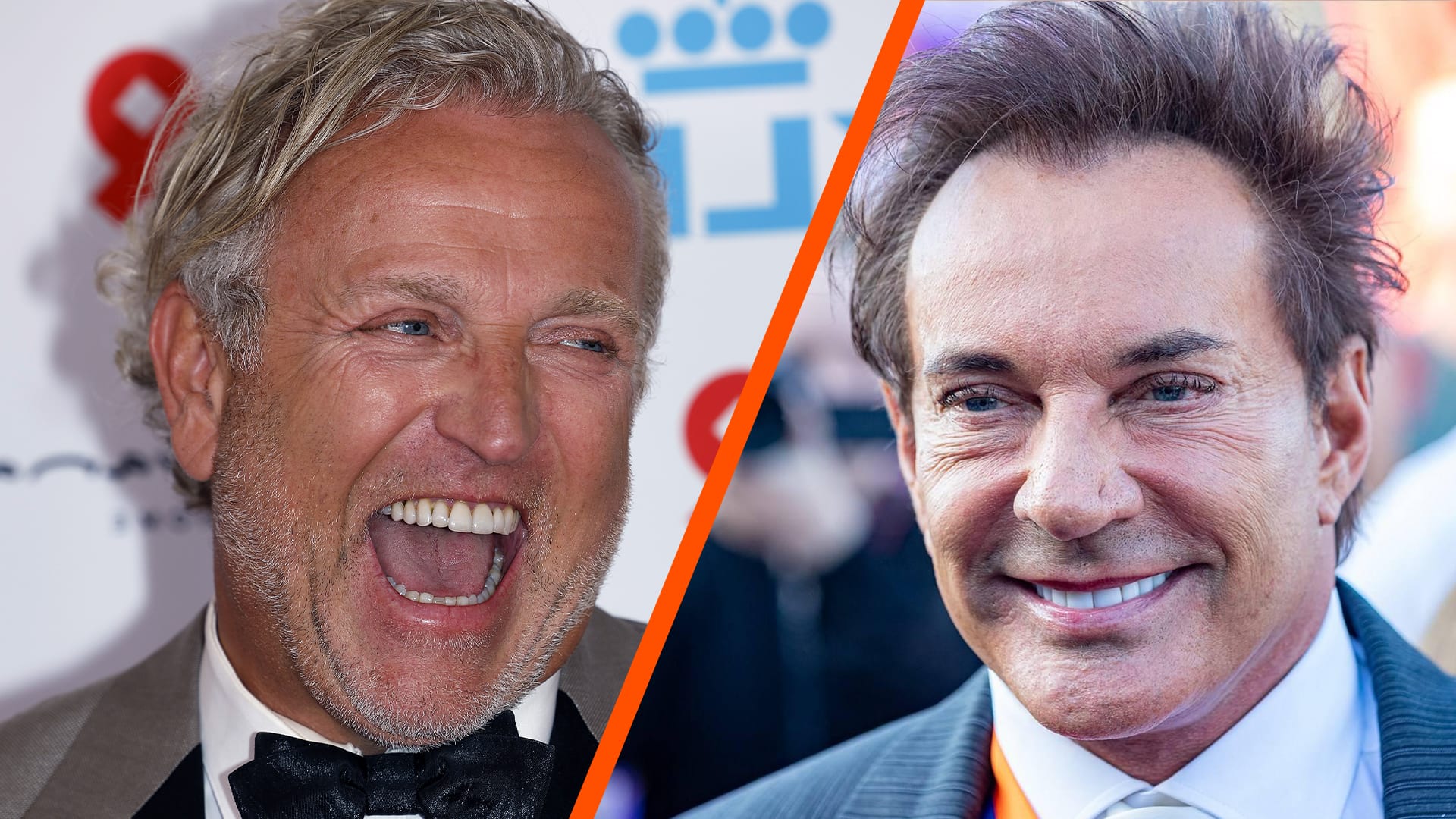 Gordon grapt opnieuw facelift Gerard: 'Zelfde dokter' | Shownieuws