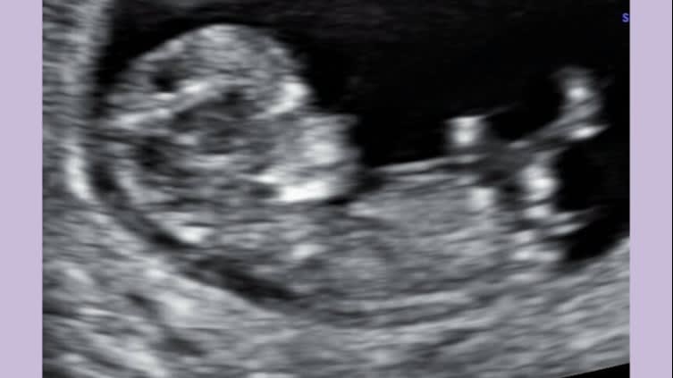 Babynieuws! Bekende musicalactrice in verwachting | Shownieuws