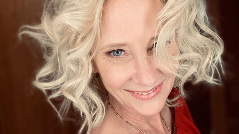 Anna Heche verkeert in kritische toestand