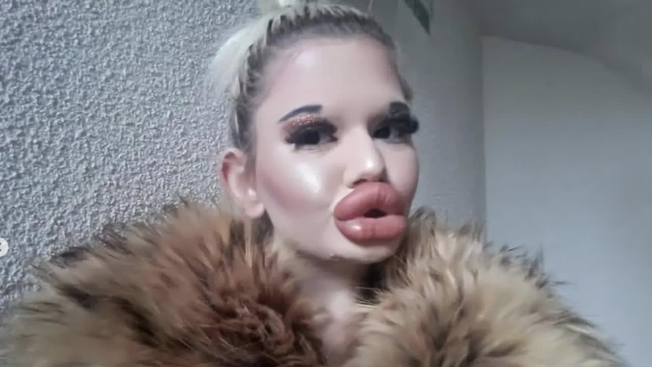 Bulgaarse influencer heeft grootste lippen ter wereld: 'Eigen kijk op schoonheid'