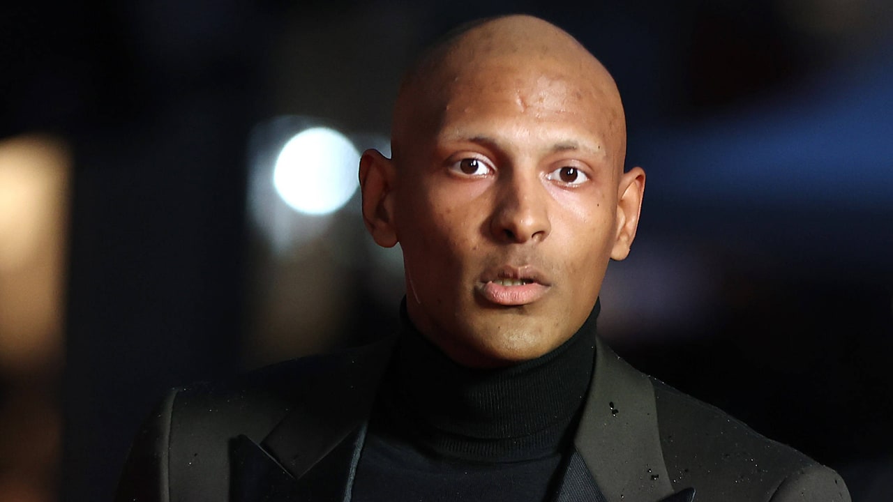 Nieuwe operatie voor Sébastien Haller vanwege teelbalkanker