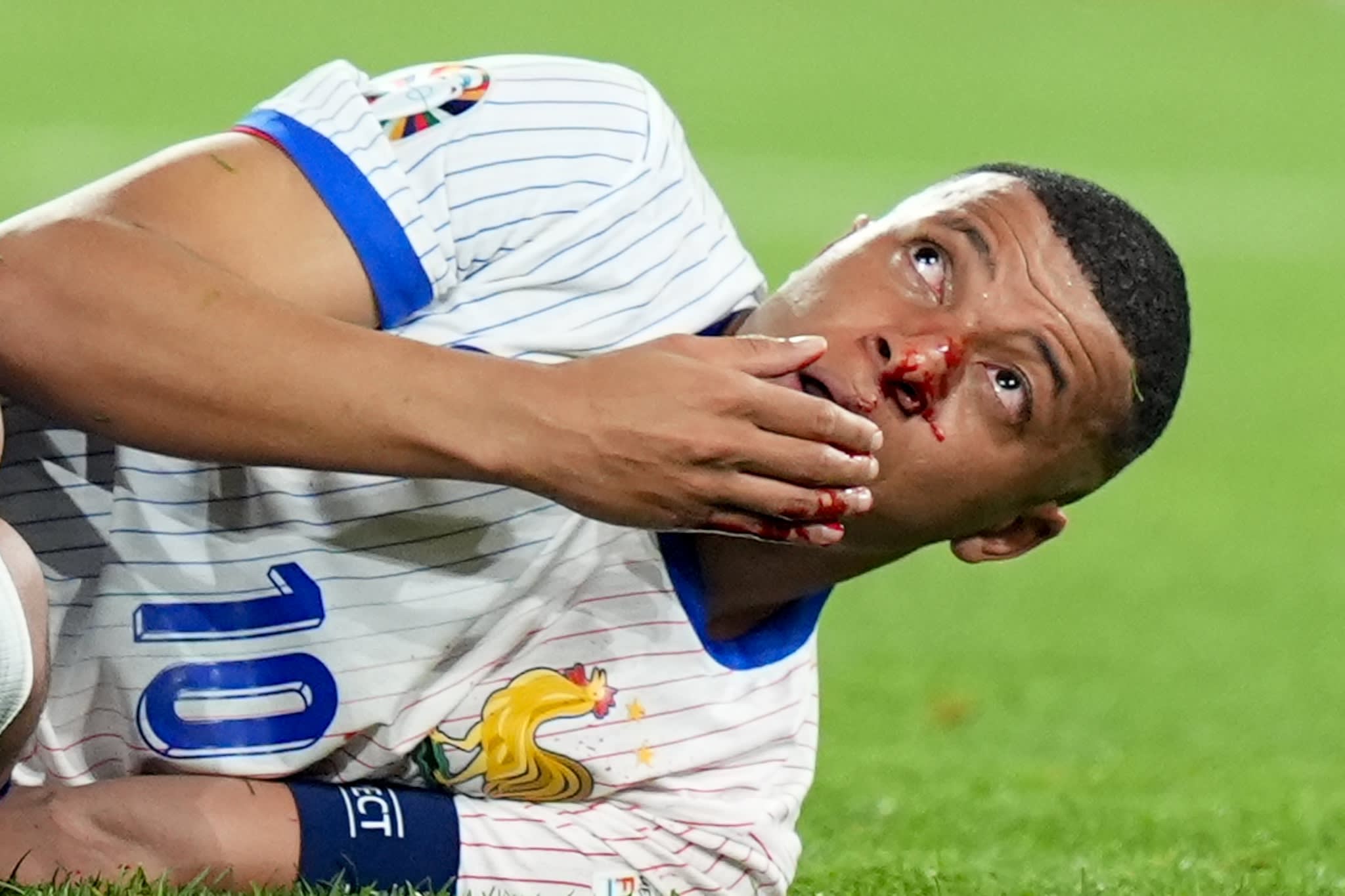 Franse sterspeler Mbappé breekt neus, inzetbaarheid tegen Oranje onzeker