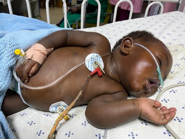 Slecht nieuws voor doodzieke baby Teleza: geen Nederlands paspoort