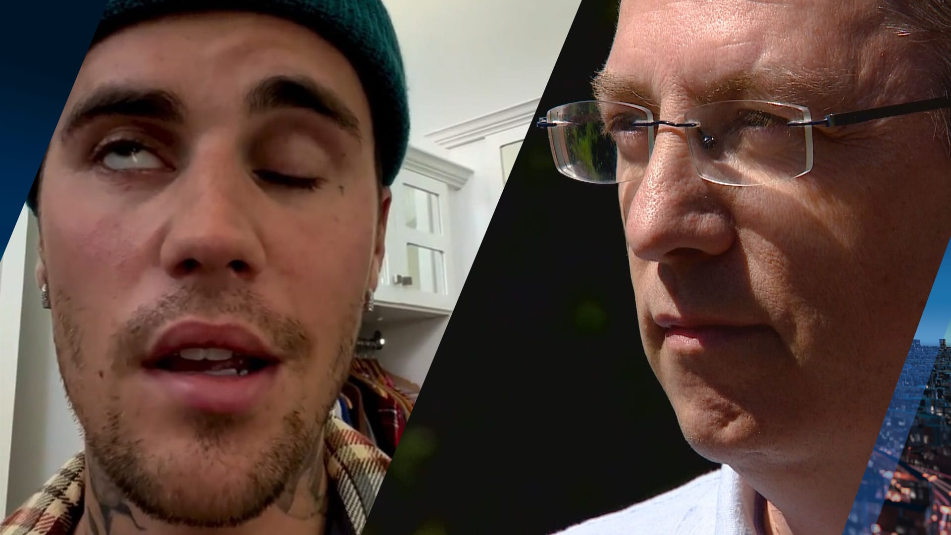 Eric heeft net als Justin Bieber syndroom van Ramsay-Hunt: dit staat de ster te wachten