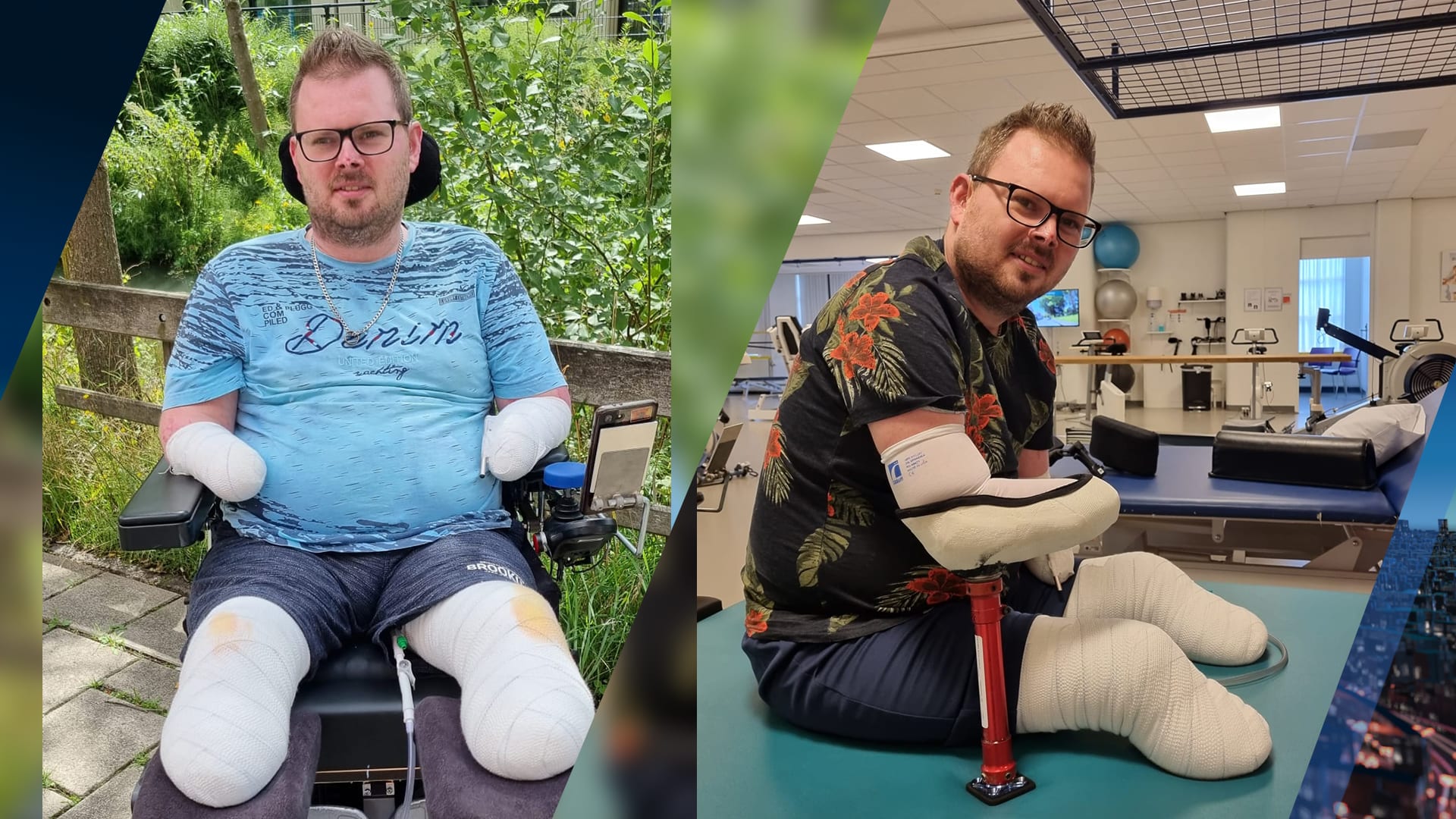 Al 150.000 euro opgehaald bij crowdfundingsactie voor Kees (34) die na griep zijn ledematen verloor