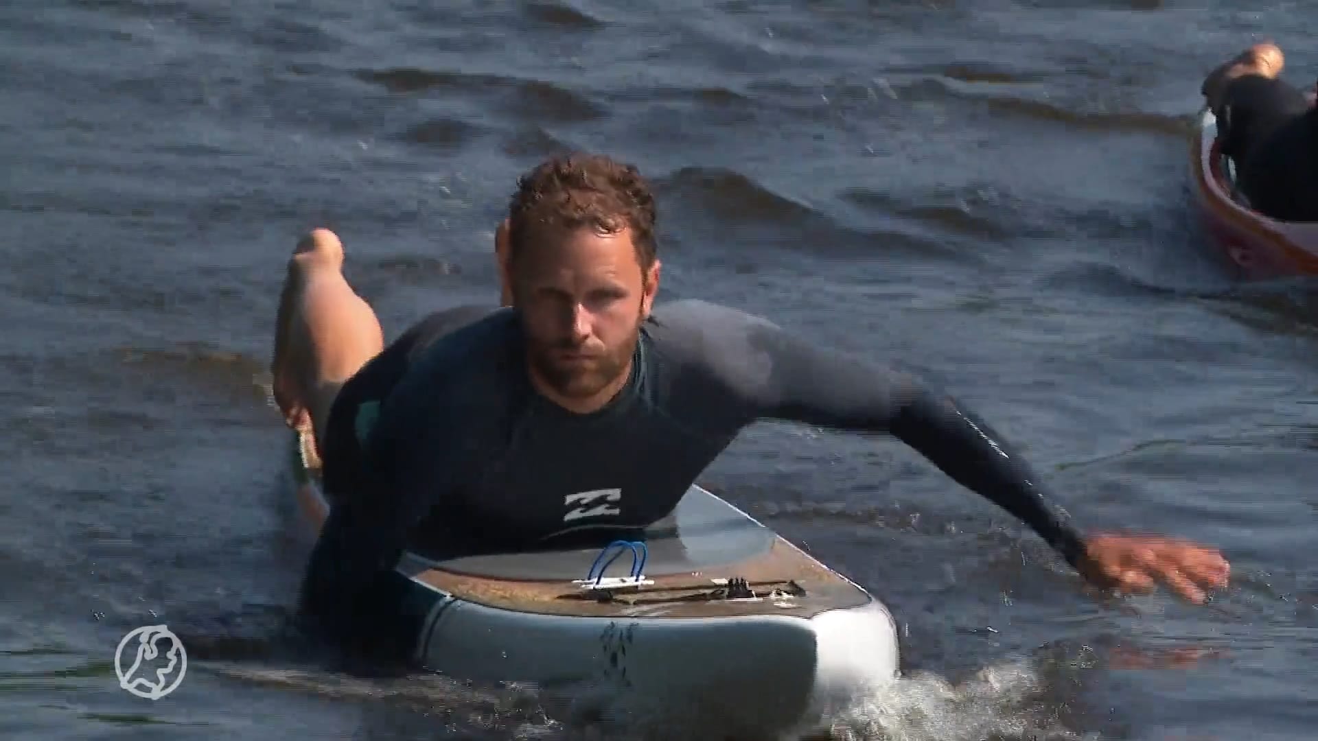 Surfer Jasper (38) heeft huidkanker en wordt niet meer beter: 'Ga bewust om met de zon'