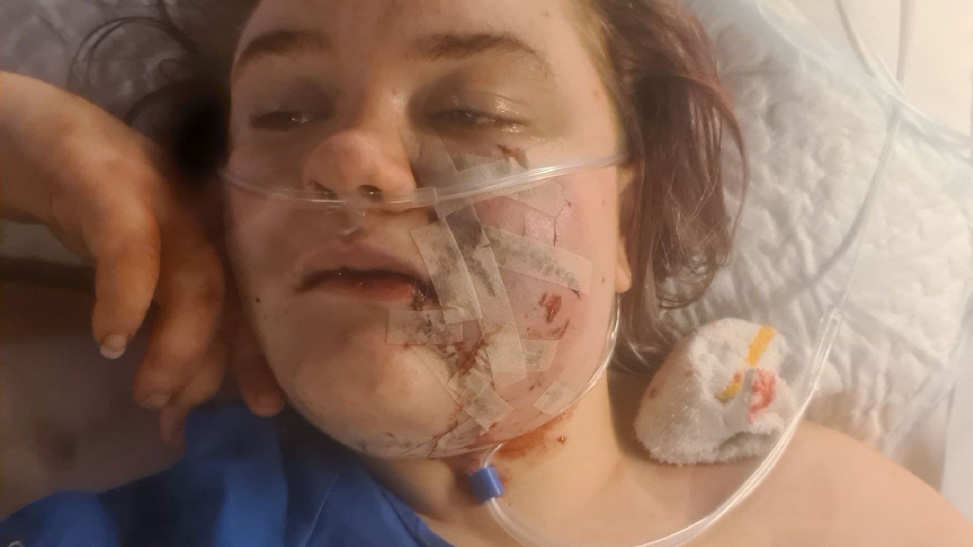 Agressieve pitbull die gezicht van Julia (18) aan flarden scheurde doodgeschoten door politie