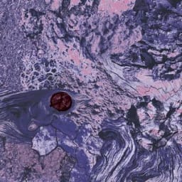 Flares - They Don't Care About Us