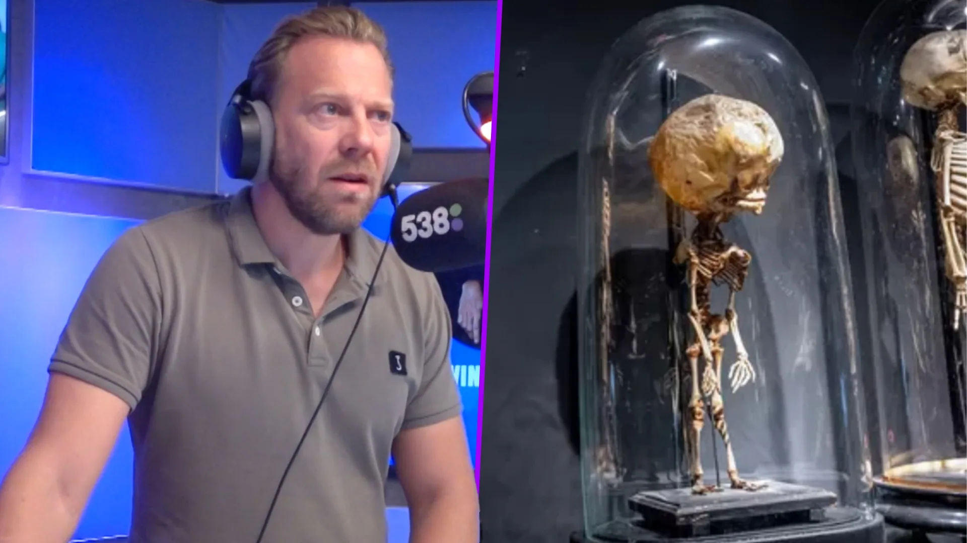 Erwin over de verkoop van waterhoofdbaby-skelet 💀