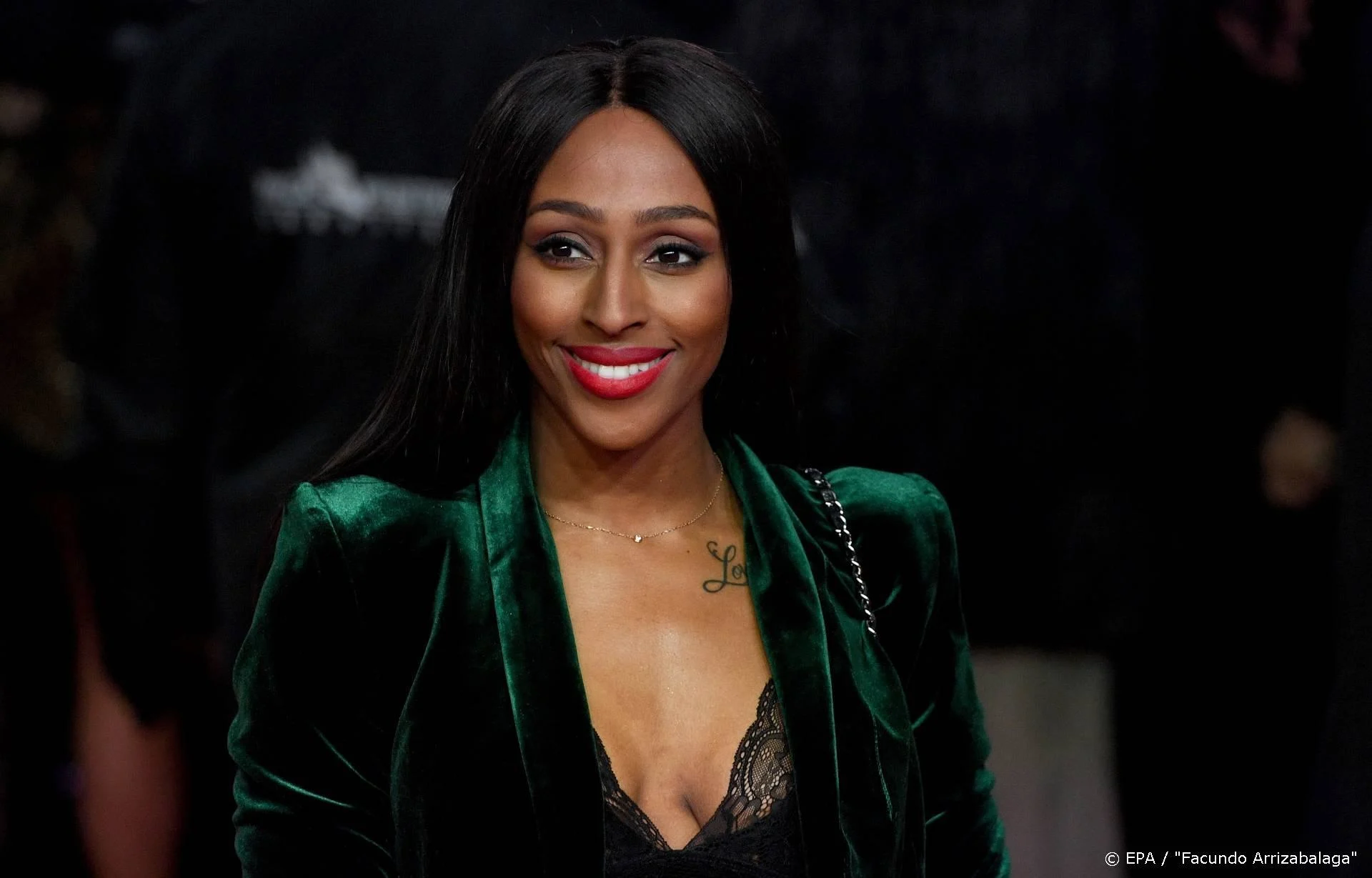 Alexandra Burke moest huid bleken
