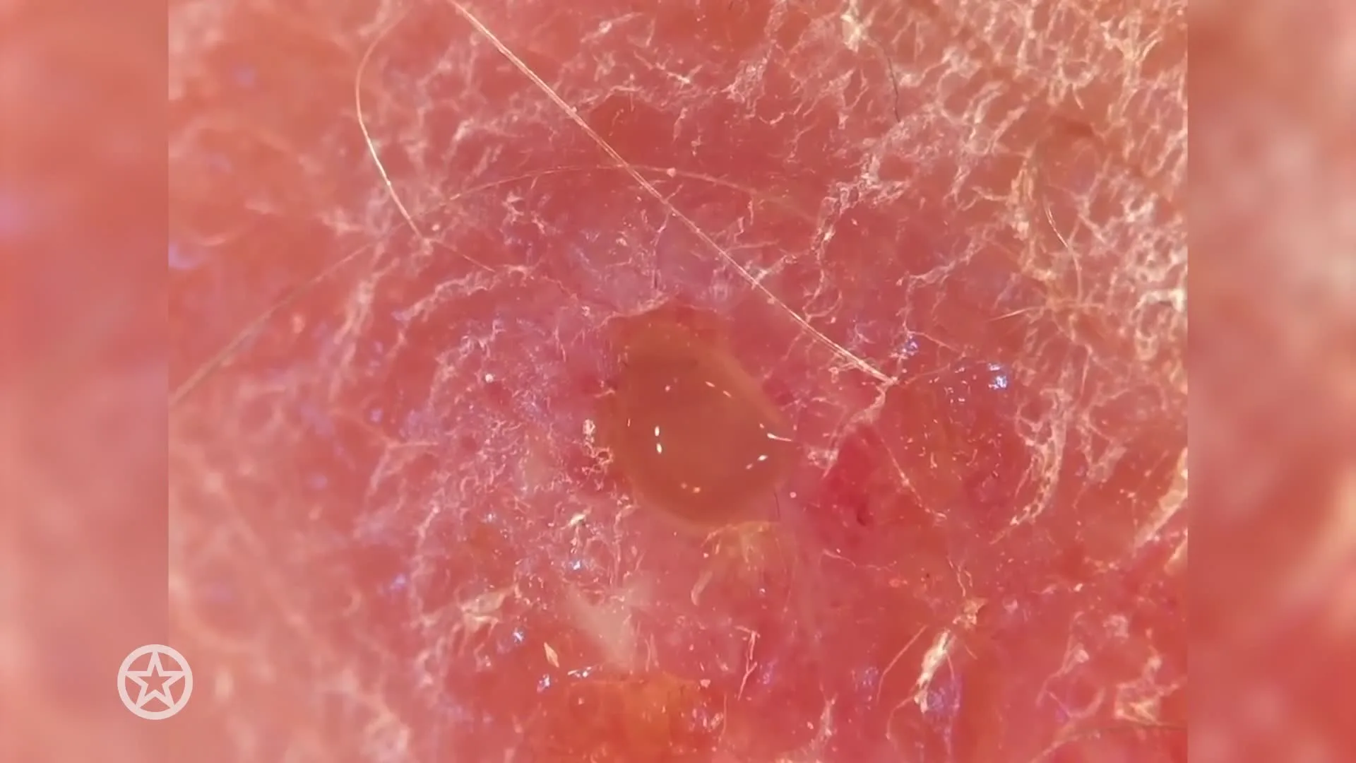 Freek geeft update over derde larf