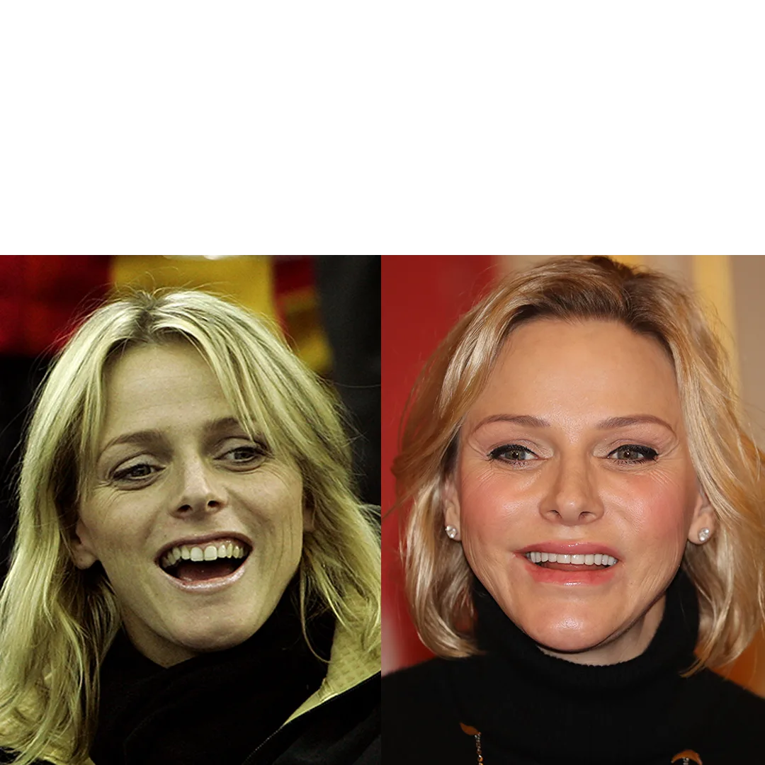 5 royals die niet bang zijn voor een spuitje