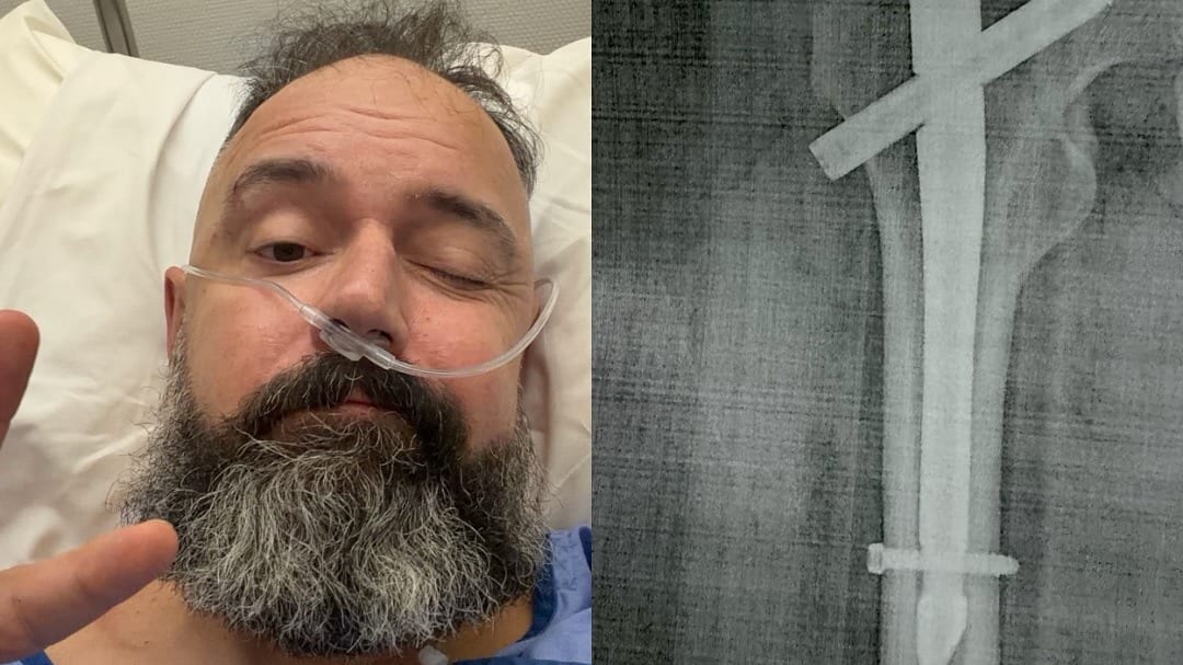 Tv-kok Ramon Brugman in ziekenhuis na ongeluk met e-bike