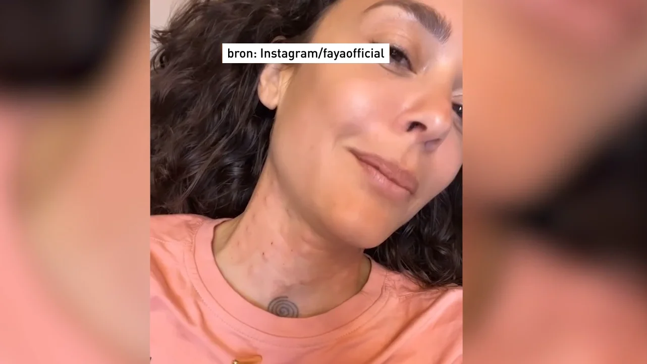 Fajah Lourens shockeert met 'creepy' verjongingsbehandeling