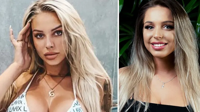 WTF: Opgespoten lippen Temptation-Shirley op ontploffen