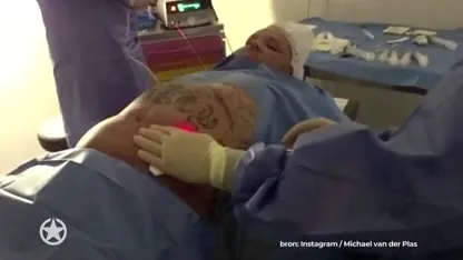 ZIEN: Michael van der Plas deelt beelden heftige buikoperatie