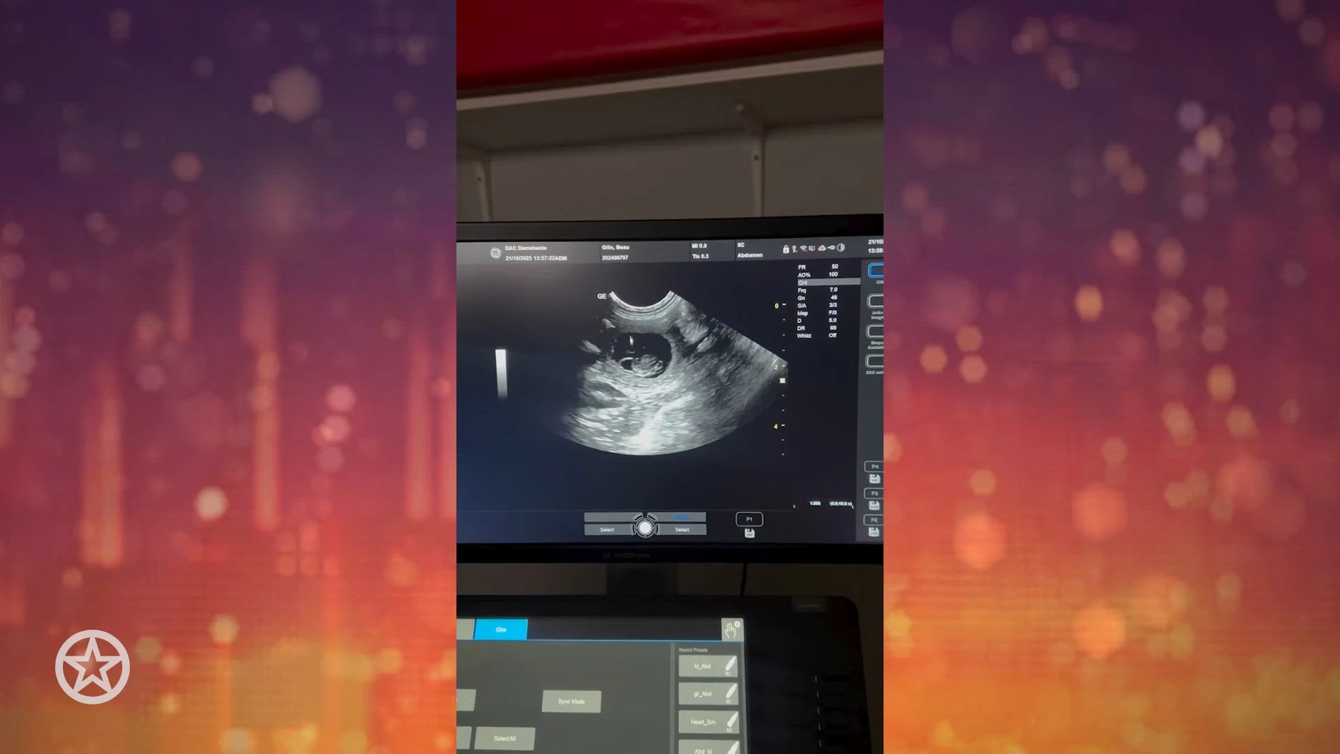 Wendy van Hout en Peter Gillis delen beelden van zwangere hond