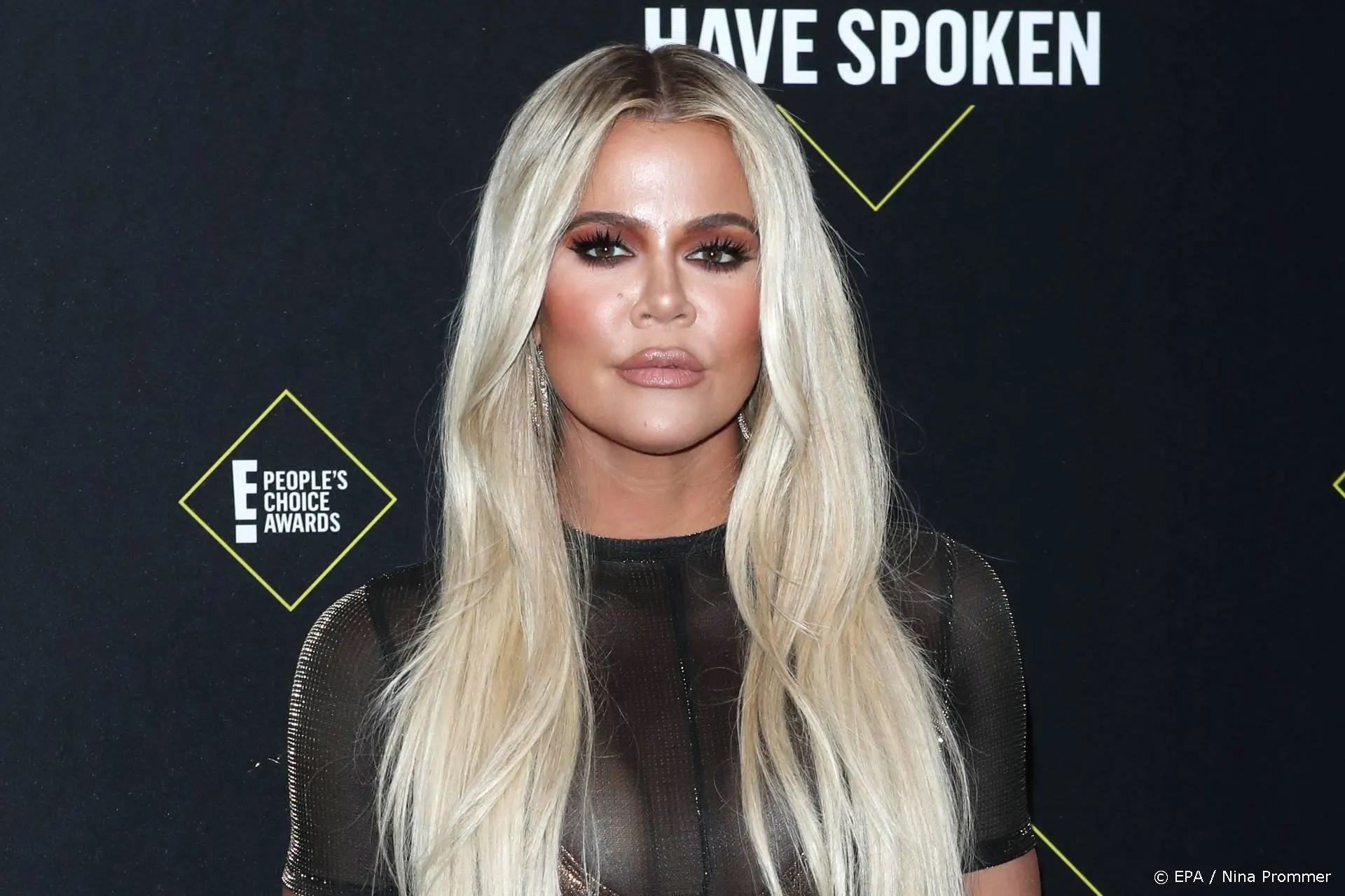 Khloé Kardashian openhartig over plastische ingrepen
