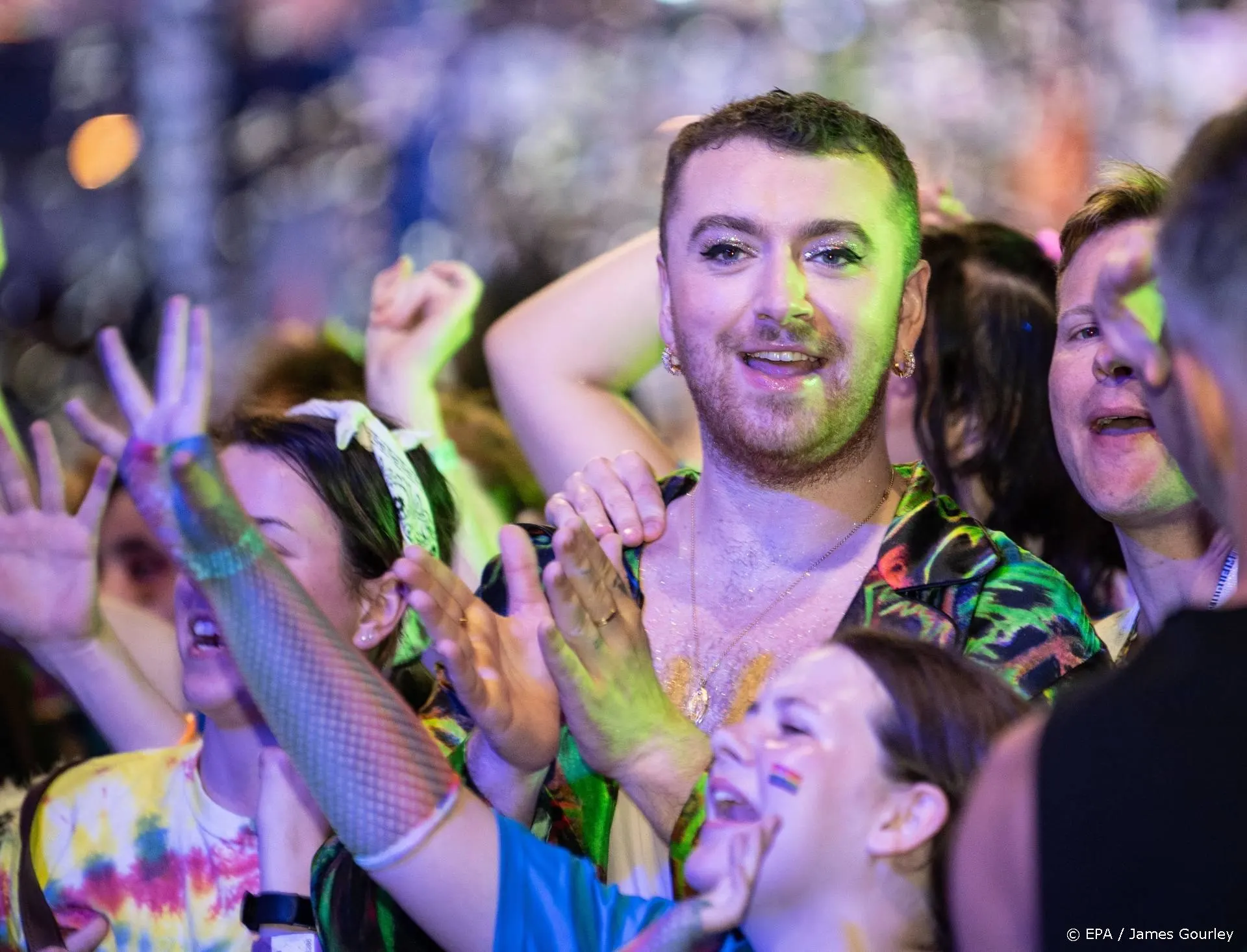 Sam Smith dolblij met haartransplantatie