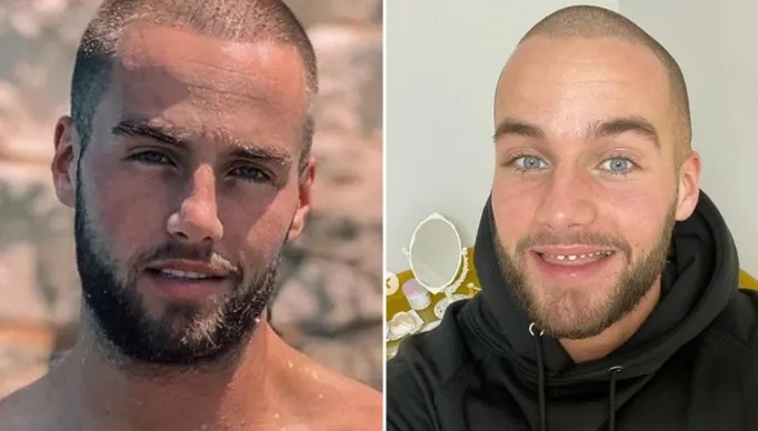 Donny Roelvink boos na kritiek op neus