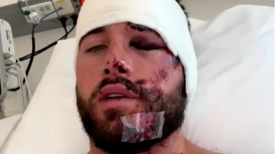 Beste vriend Donny Roelvink reageert na aanrijding