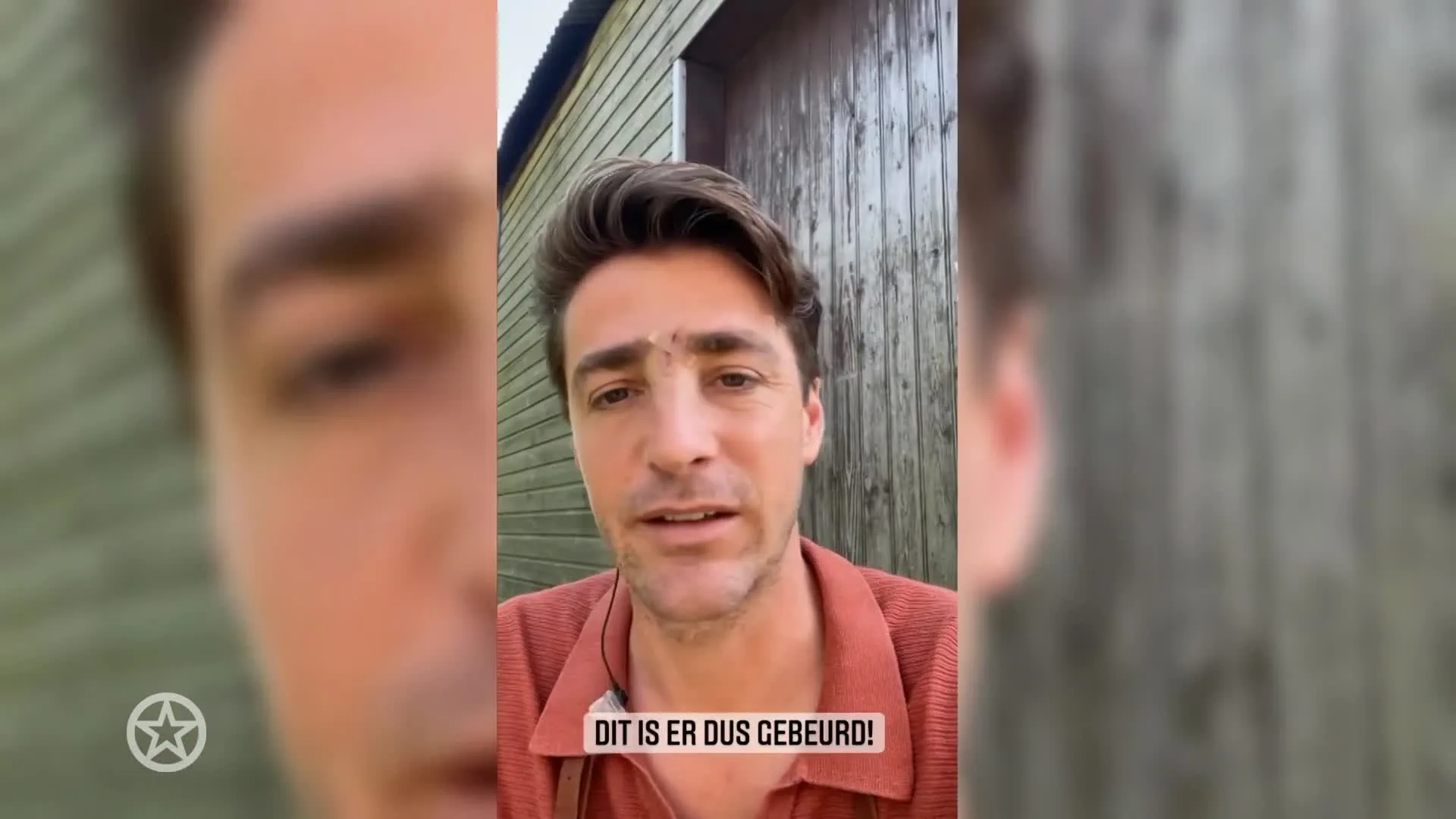 Volgers schrikken van gehavend gezicht Hugo Kennis