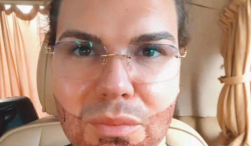 Roy Donders bijt van zich af na kritiek op baard