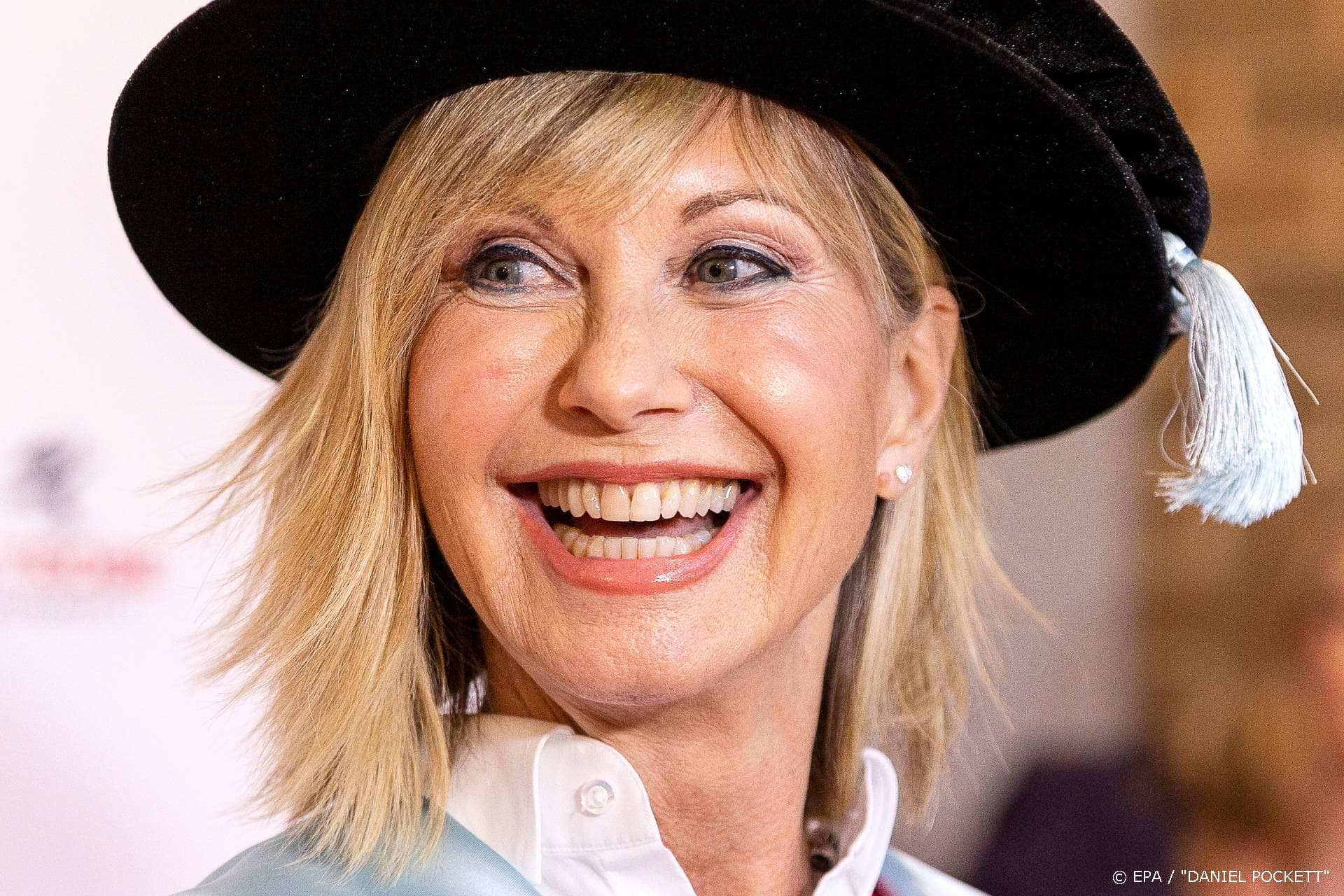 Olivia Newton-John roept fans op zelf mondkapjes te maken