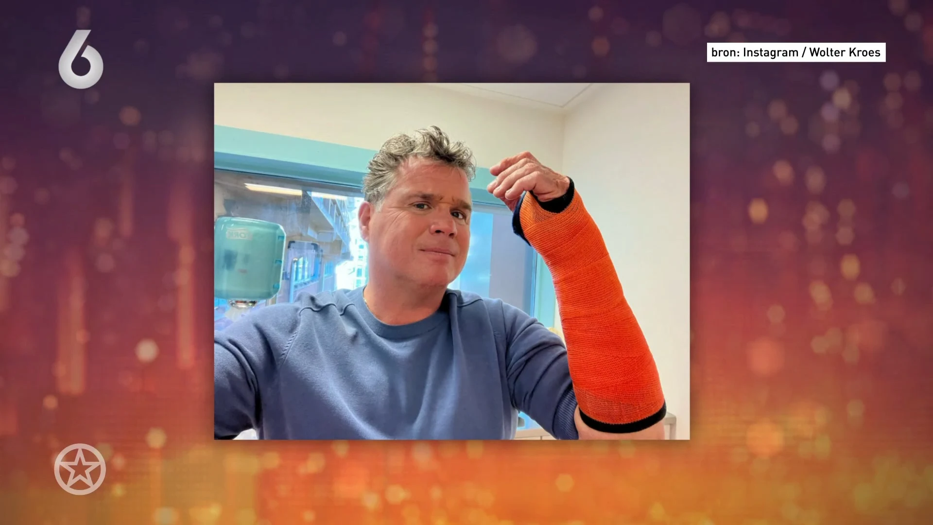 Wolter kroes heeft bij het Televizier-gala een keer zijn arm gebroken
