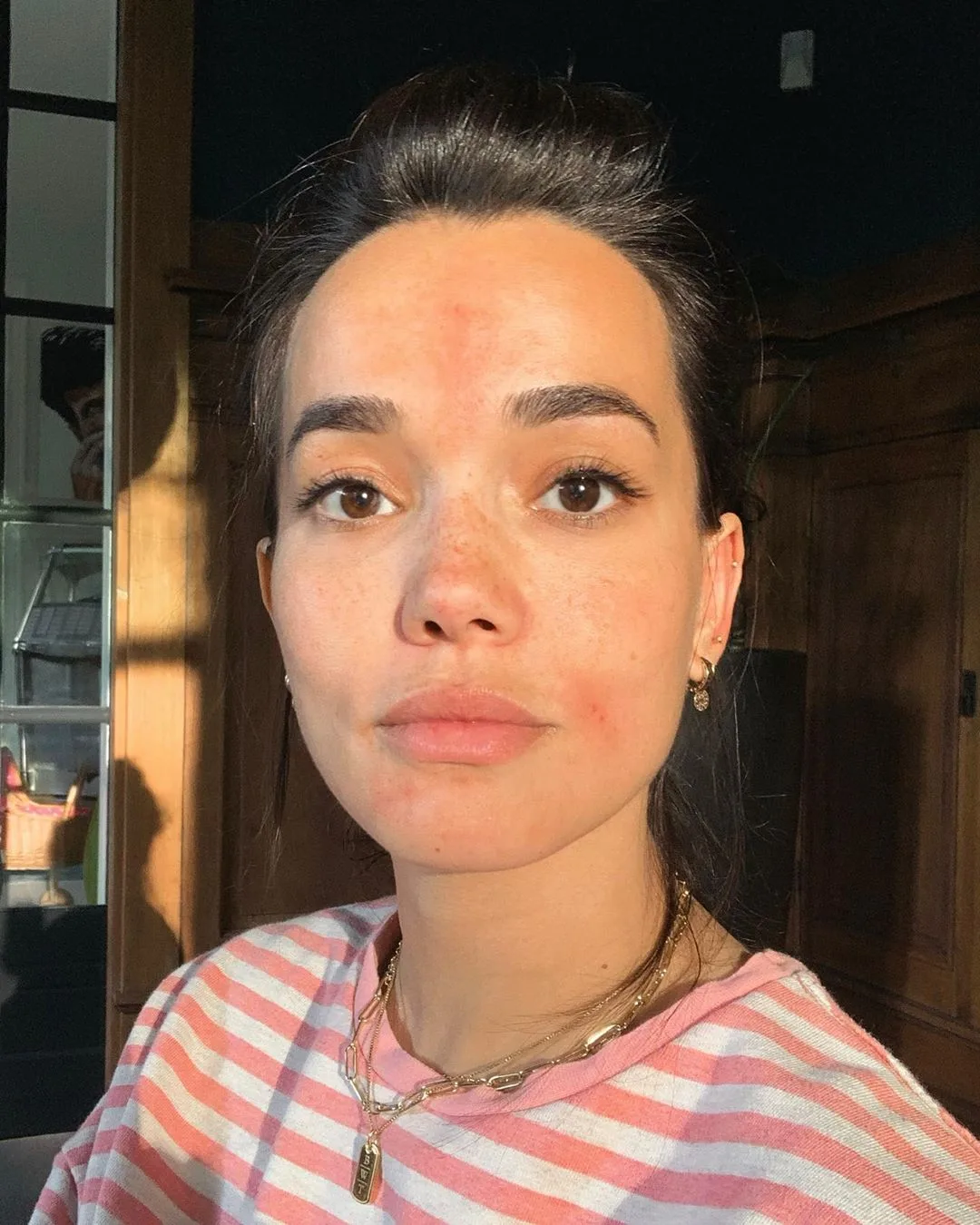 Volgers Bibi Breijman bezorgd na kwelling