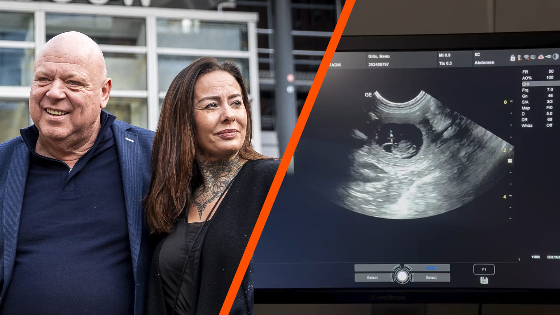 Vriendin Peter Gillis verwart volgers met gezinsuitbreiding