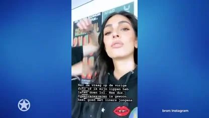 Anna Nooshin onder vuur vanwege 'vollere lippen'