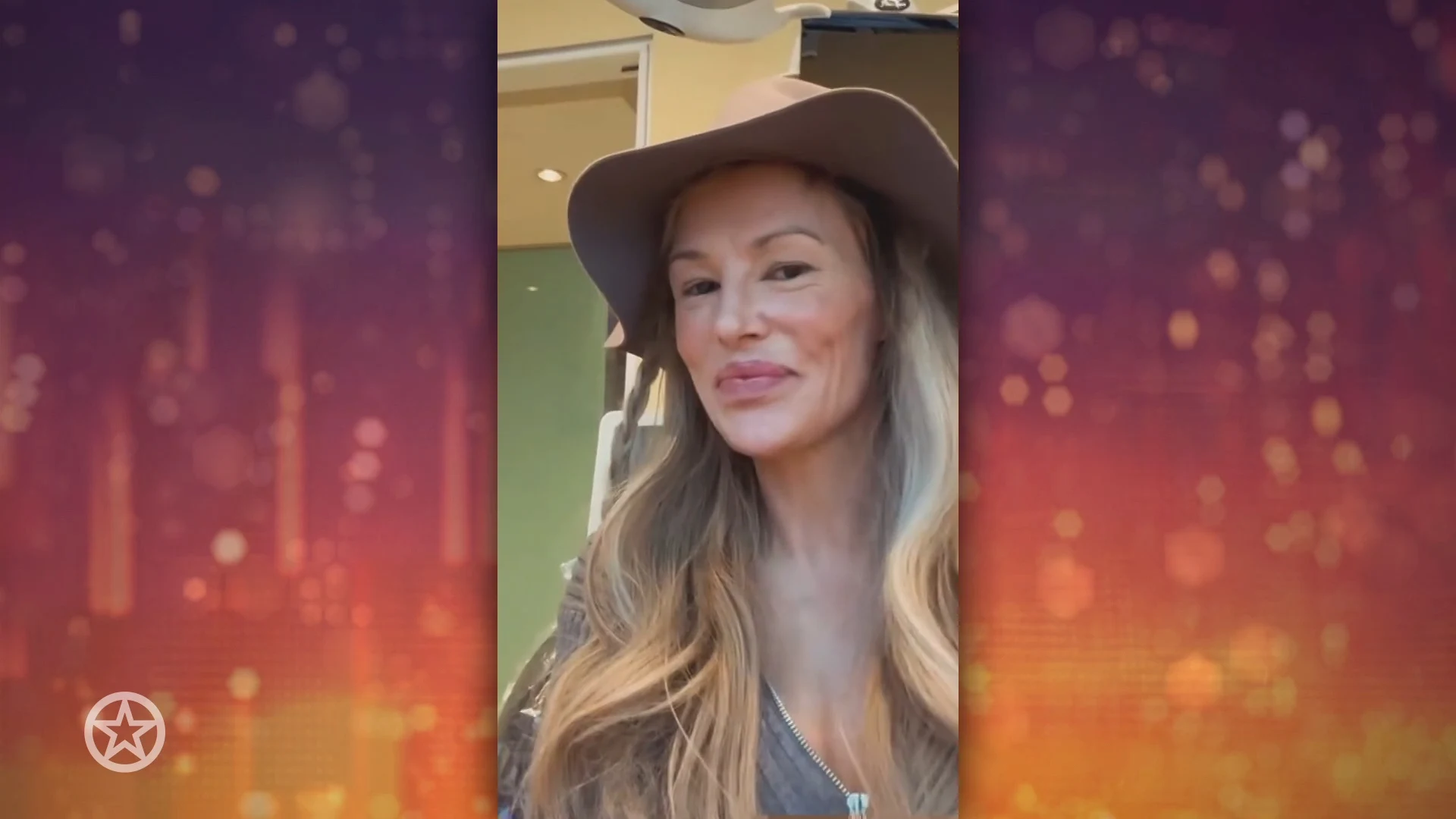 Gezicht Brandy Glanville verminkt