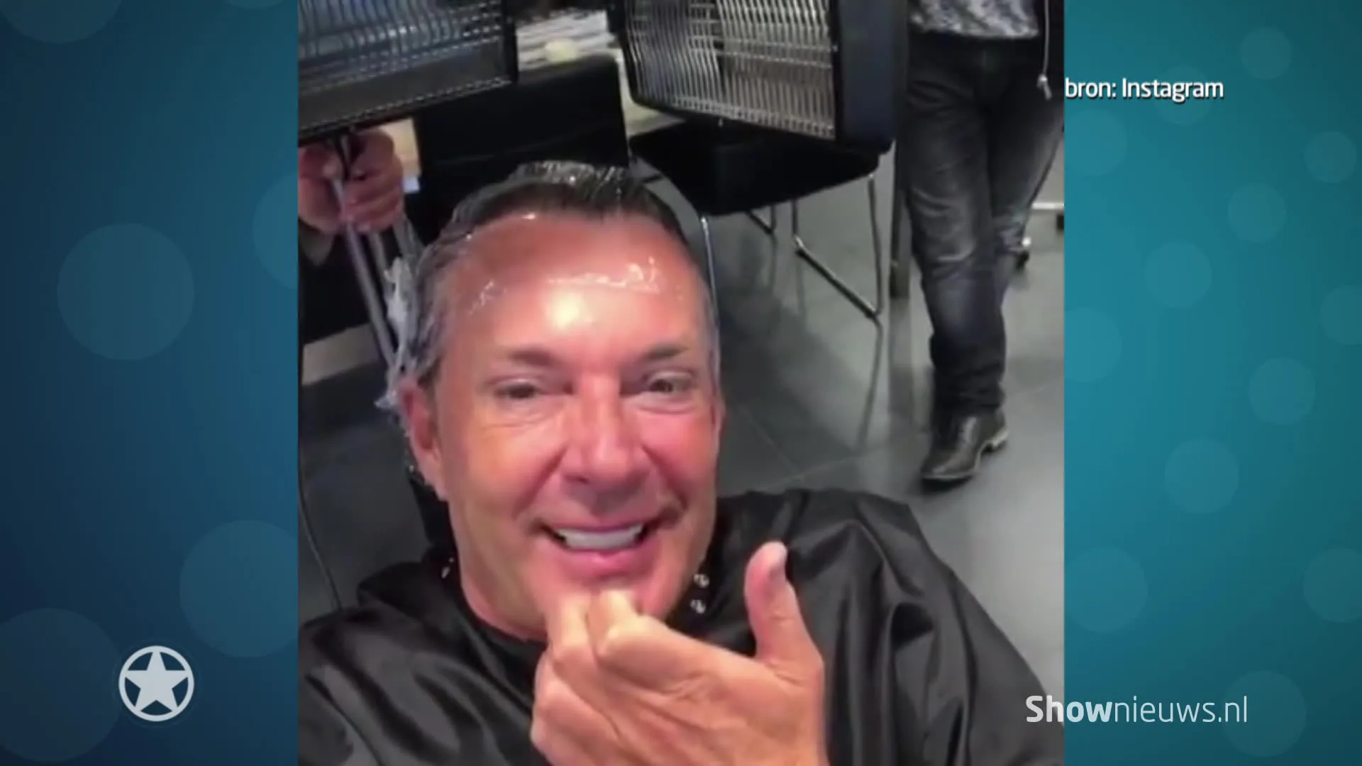 Opnieuw botox behandeling voor Gerard Joling