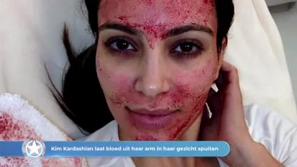 Peniscrème en kattenbakvulling: De bizarste wellness-geheimen van de sterren!