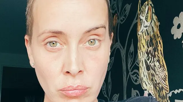 Dit vindt Ali B van 'kale look' Anouk