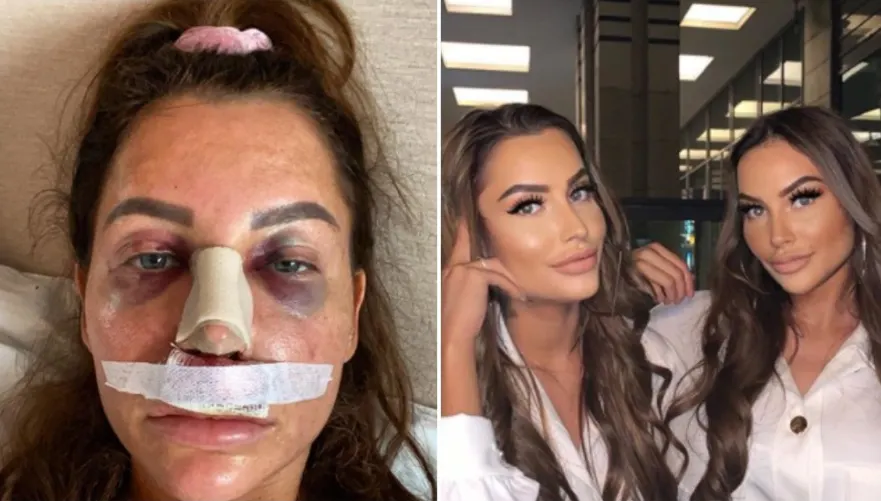 Terror Twins zwaar onder vuur: ‘Verminking!’