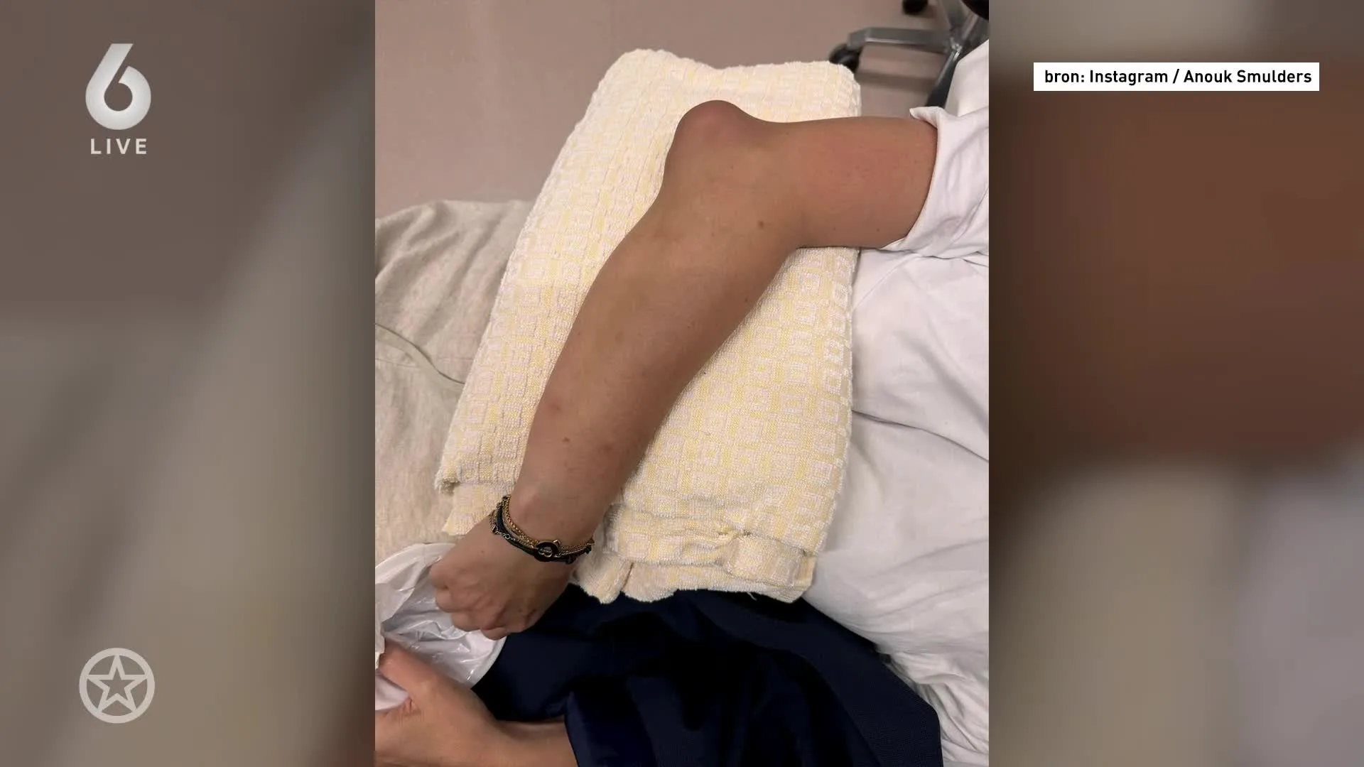 Anouk Smulders in ziekenhuis opgenomen