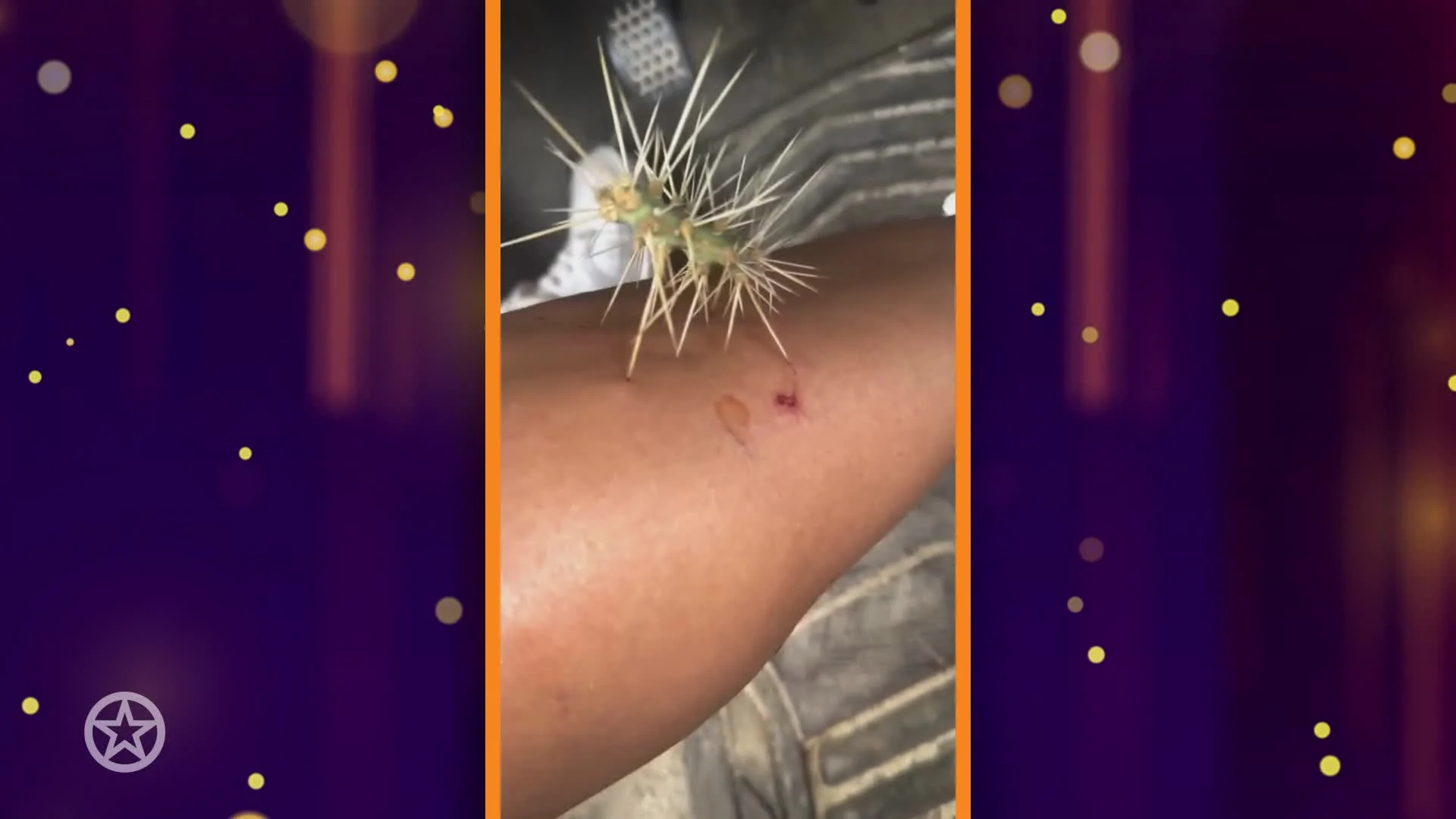 Nicolette Kluijver naar ziekenhuis door cactus in haar been