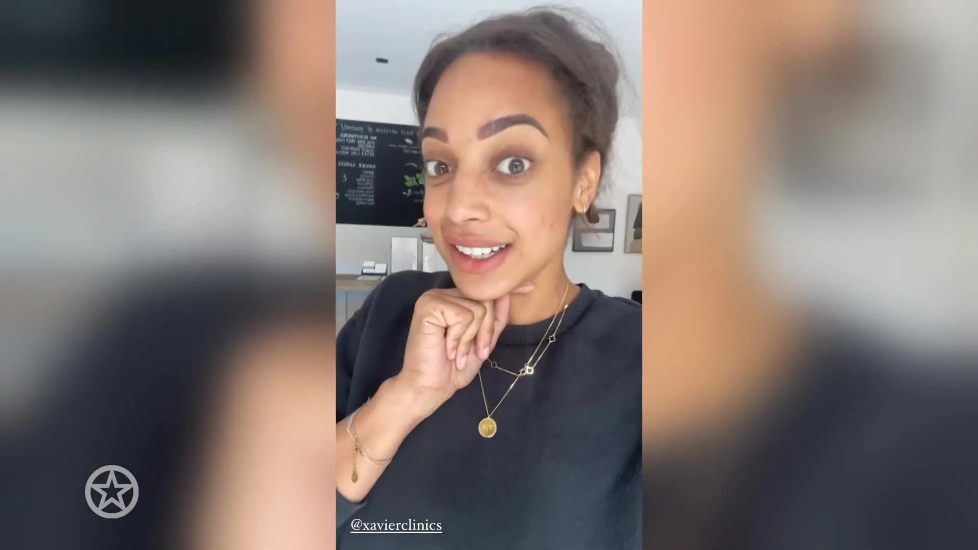 Channah Koerten ondergaat botoxbehandeling