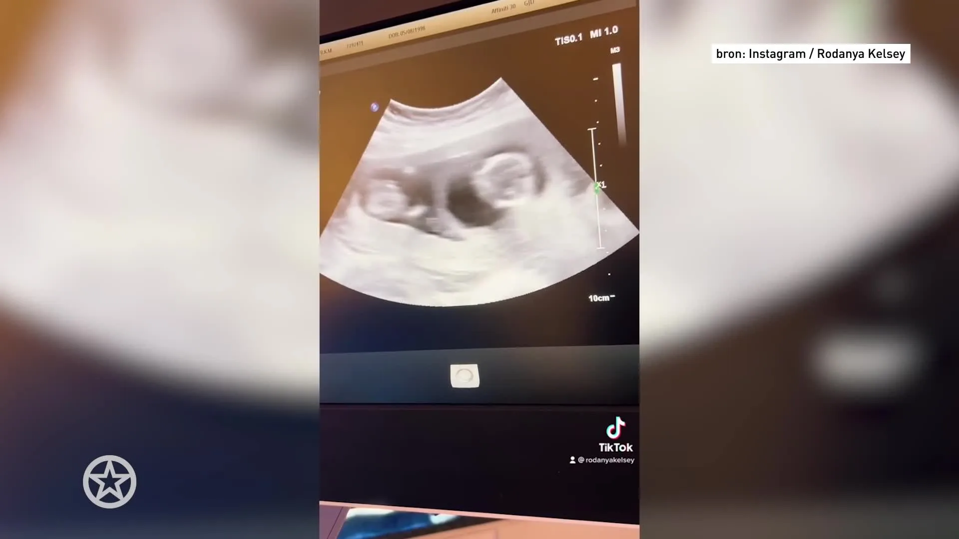 Temptations Rodanya zwanger van een tweeling