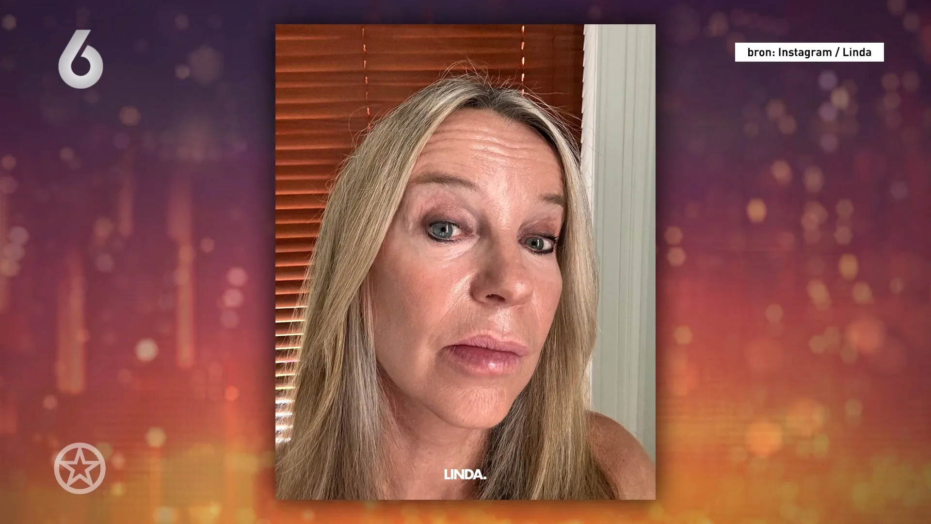 Linda de Mol gestoken door een wesp tijdens opnames Gooische Vrouwen