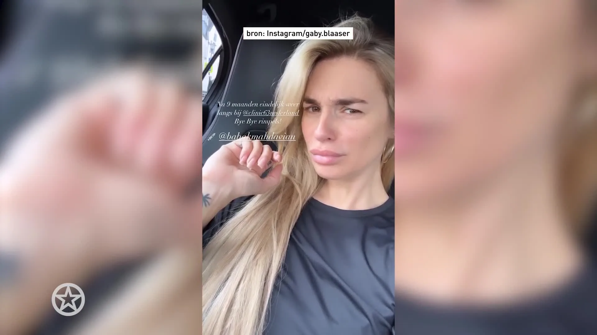 Gaby Blaaser mag weer aan de botox