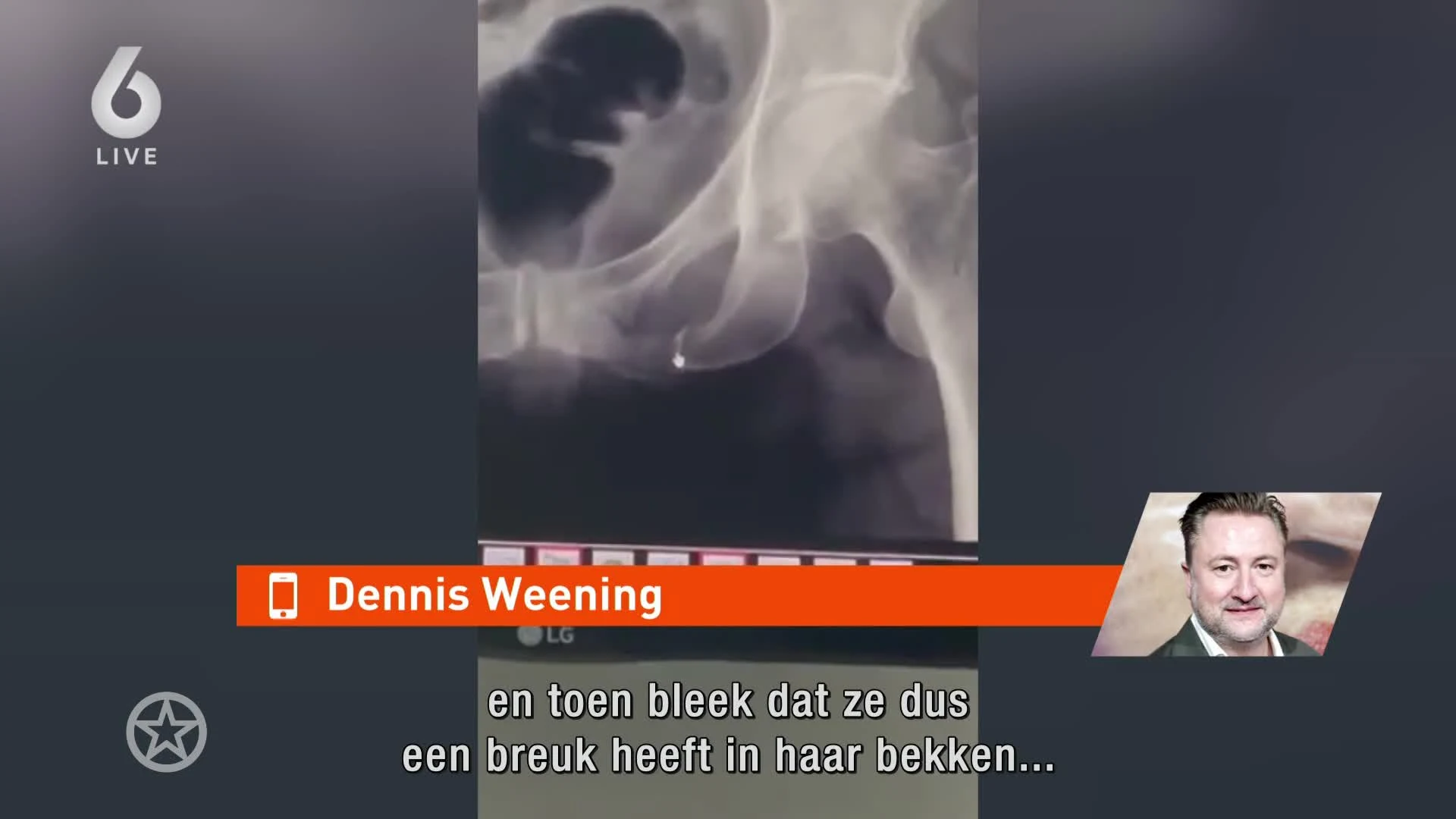 Zo gaat het nu met moeder Dennis Weening na lelijke val