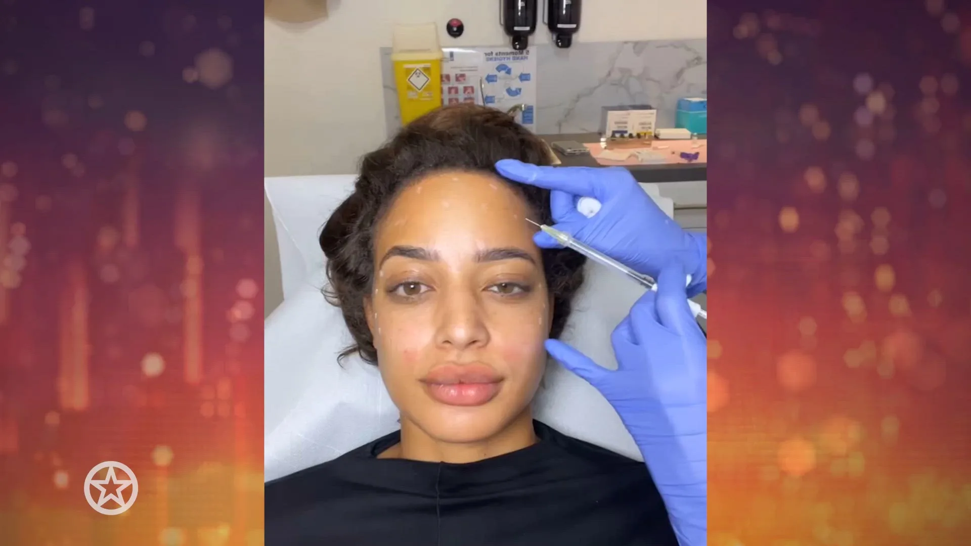 Channah Koerten opnieuw aan de botox