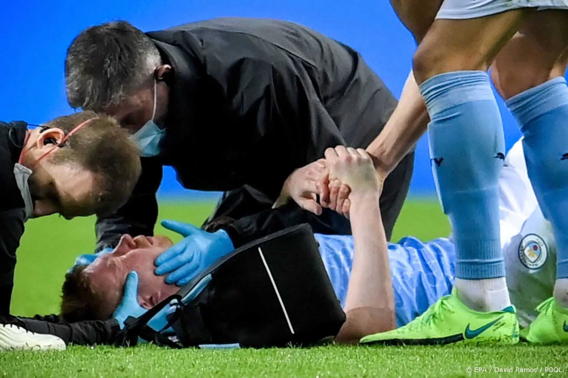 De Bruyne heeft een flinke schade aan zijn hoofd opgelopen tijdens CL-finale