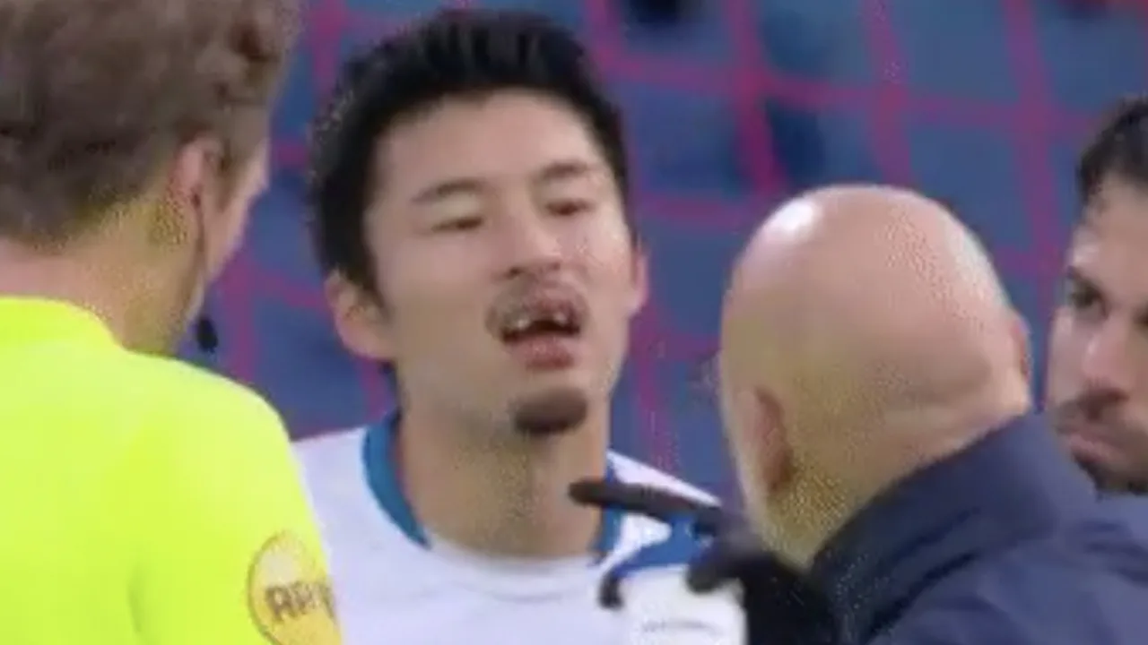 Pijnlijk: PEC Zwolle-speler Yuta Nakayama verliest voortanden tegen Feyenoord