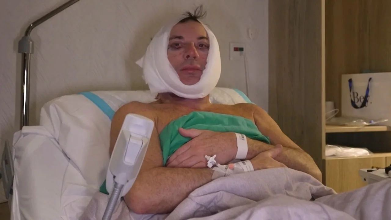 Gerard Joling toont eerste beelden na zijn gezichtsoperatie