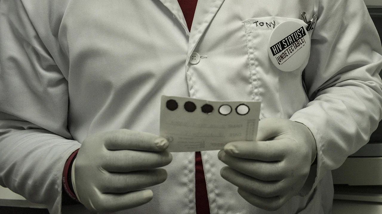 Man (36) komt terug van vakantie met corona, apenpokken én hiv